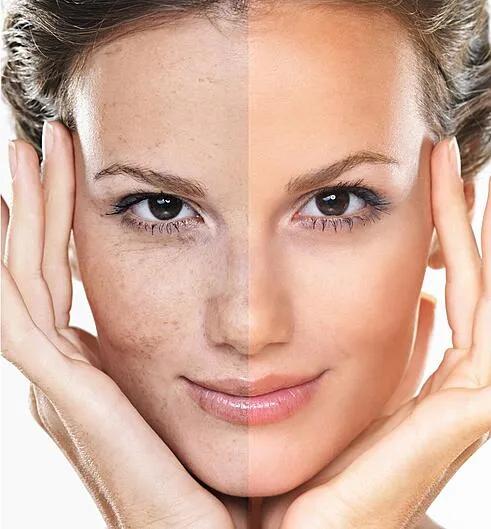 Cosmetic Laser Professionals MED SPA